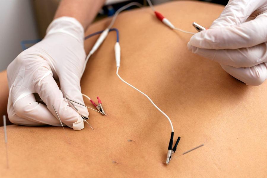 Axomera-Therapie – Abbildung 1