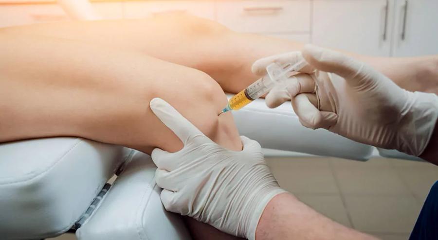 Eigenbluttherapie (PRP) – Abbildung 2